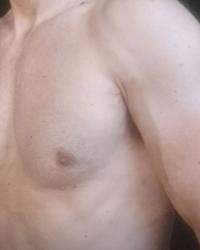 Foto 6 de 9
